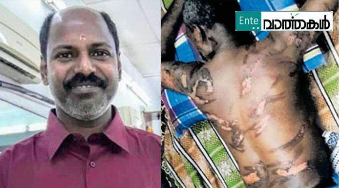 കൂട്ടായ പരിശ്രമത്തിന് വിജയം; മലേഷ്യയില്‍ തൊഴിലുടമയുടെ ക്രൂരപീഡനത്തിനിരയായ ഹരിദാസിന് മോചനം