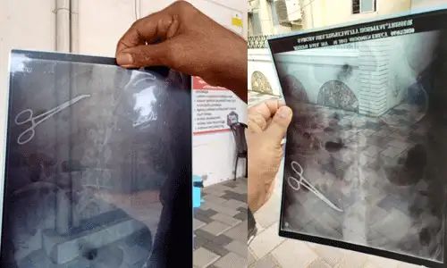 ശസ്ത്രക്രിയക്കിടെ കത്രിക വയറില്‍; ഡോക്ടര്‍ക്കെതിരെ കേസ്