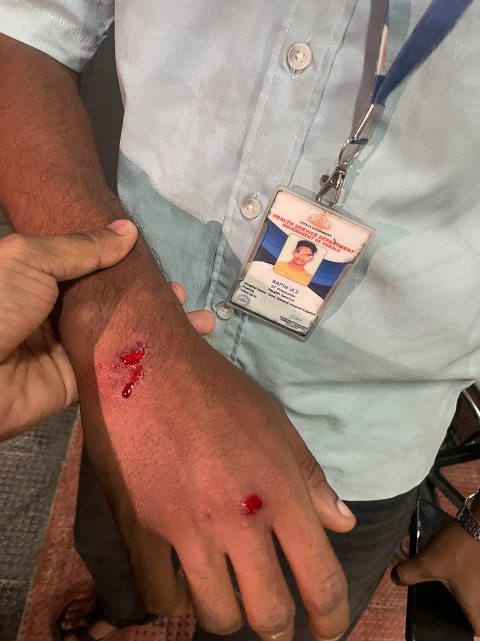 കൽപ്പറ്റ കൈനാട്ടിലെ സ്വകാര്യ ലാബ് അധികൃതർ ആദിവാസി യുവാവിനെ ആക്രമിച്ചു