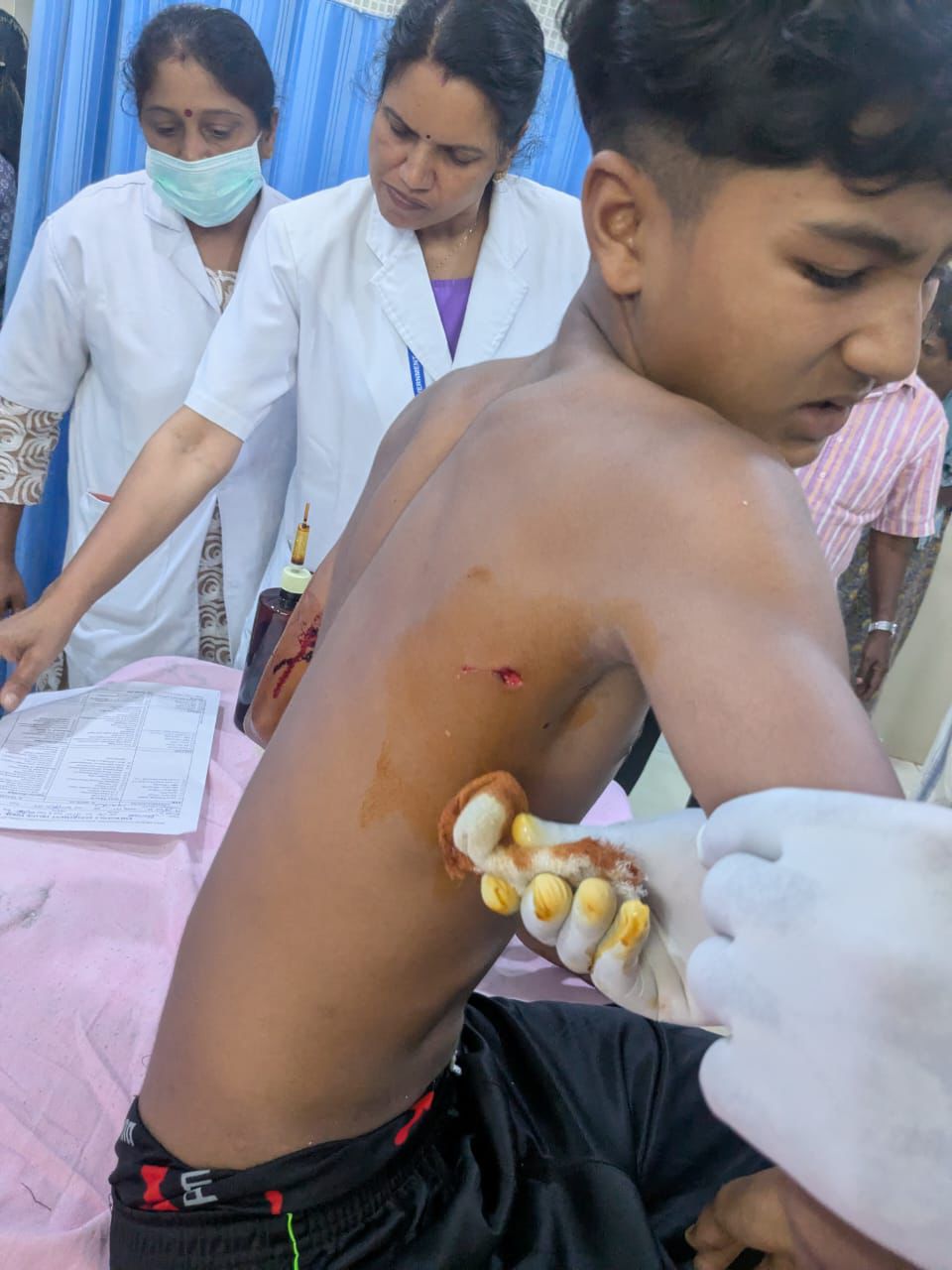 വന്യജീവിയുടെ ആക്രമണത്തിൽ വിദ്യാർത്ഥിക്ക് പരിക്ക്